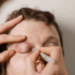 Professional Blepharoplasty Consultations Essex Safe and Informed Decisions